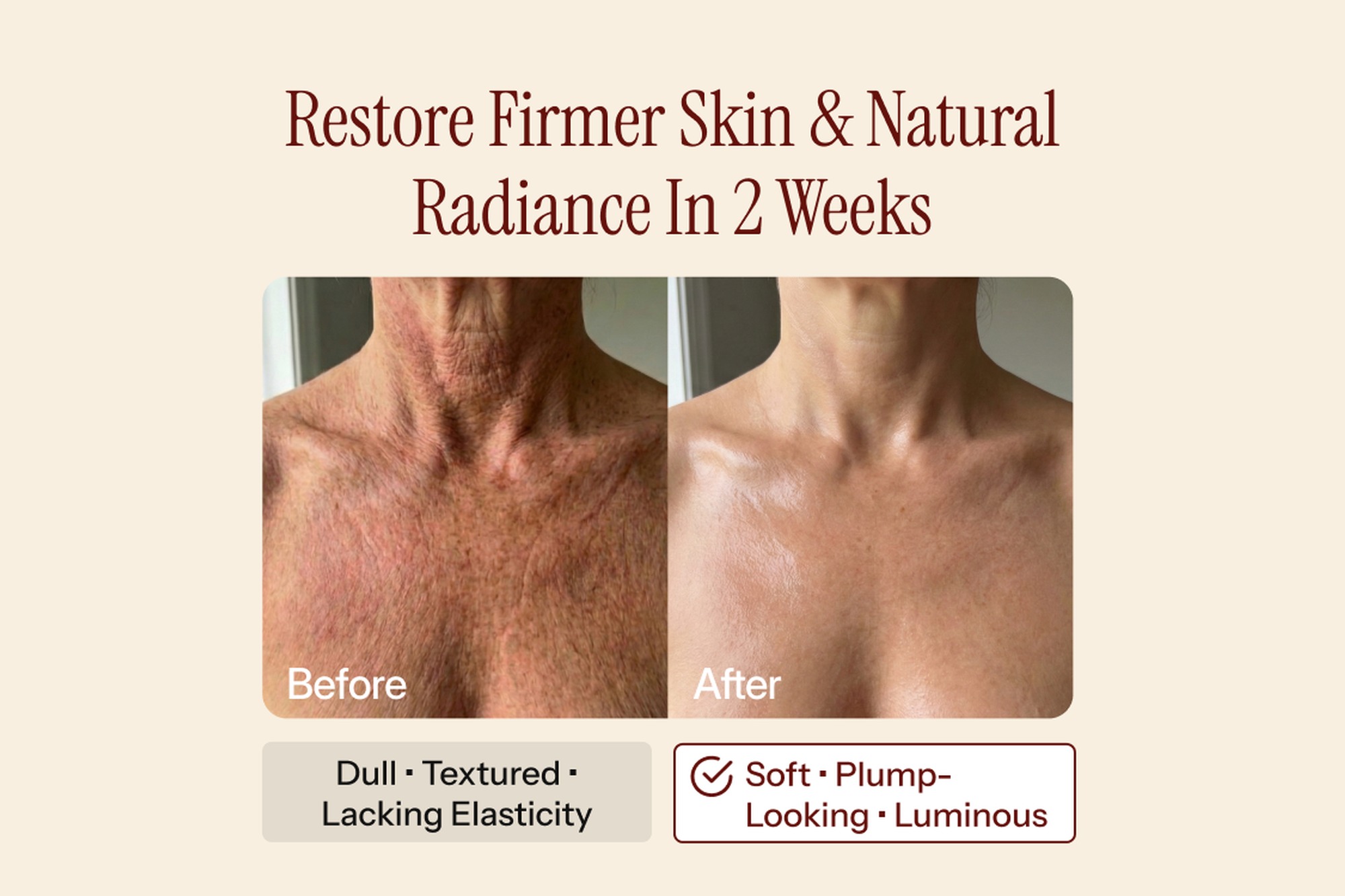 Before and After Crepey Skin Treatment Results